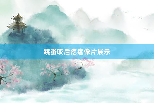跳蚤咬后疙瘩像片展示